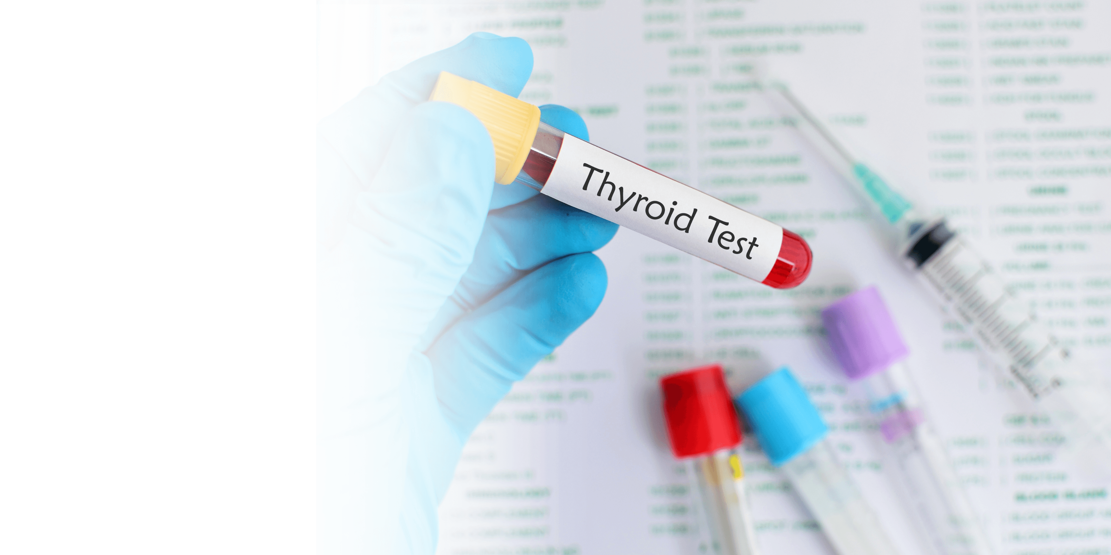 Preventive Health Check-ups